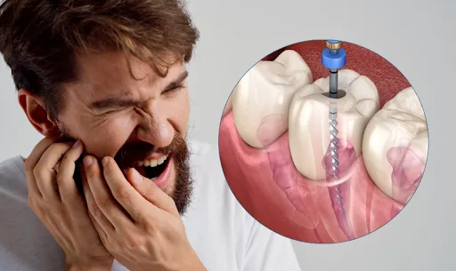 Man experiencing tooth pain with an inset showing the root canal procedure on an infected tooth